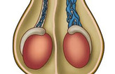 معجون واریکوسل وارداتی/طب سنتی هندی ایرانی ترکیب 16 گیاه +30 گرم ژل رویال گرید a