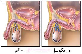 معجون واریکوسل وارداتی/طب سنتی هندی ایرانی با 30 گرم ژل رویال---یک کیلو