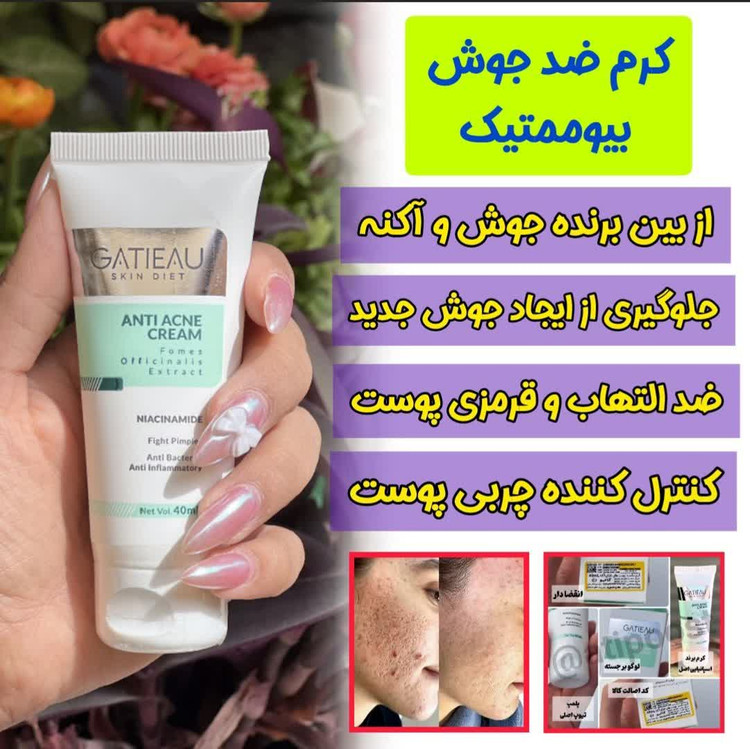 پک ژل ضد آکنه گاتیو و شوینده ویتابلا | رفع لک و منافذ باز