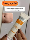 کرم رفع ترک های پوستی بارداری یا استرچ مارک برند گاتیو ایتالیا 100 میل